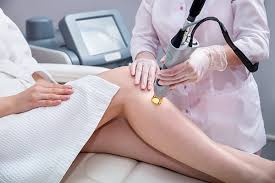 Laser Hair Removal Near Me: Convenient Solutions for Hair-Free Skin post thumbnail image