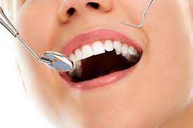 Lisa Test: Advancing Dental Technology for Precise Diagnostics post thumbnail image
