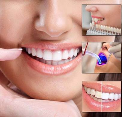 Bright Smiles, Healthy Teeth: Teeth Cleanings in Scottsdale post thumbnail image